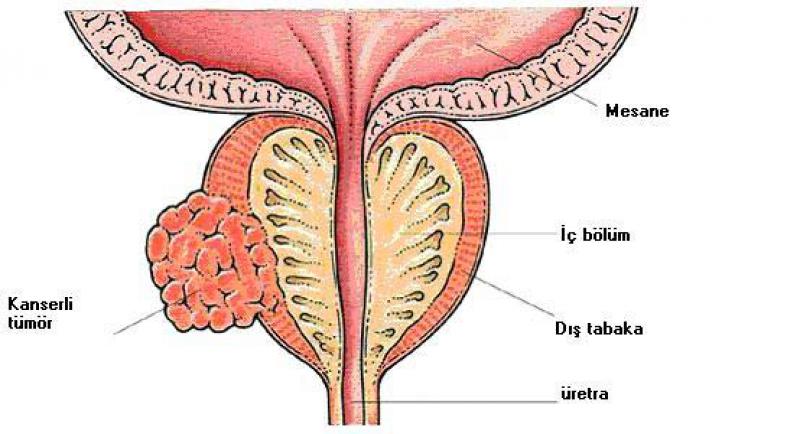 retra Nedir